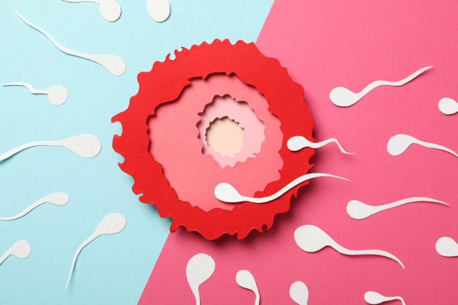 Management options for the infertile PCOS patient