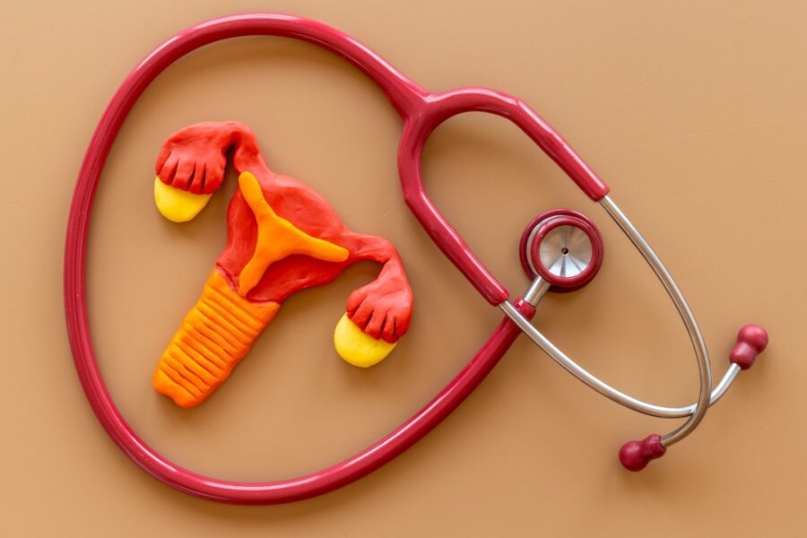 Factors influencing infertility in the PCOS patient